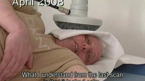 Dirk van den Boogaard survived of an inoperable brain tumour