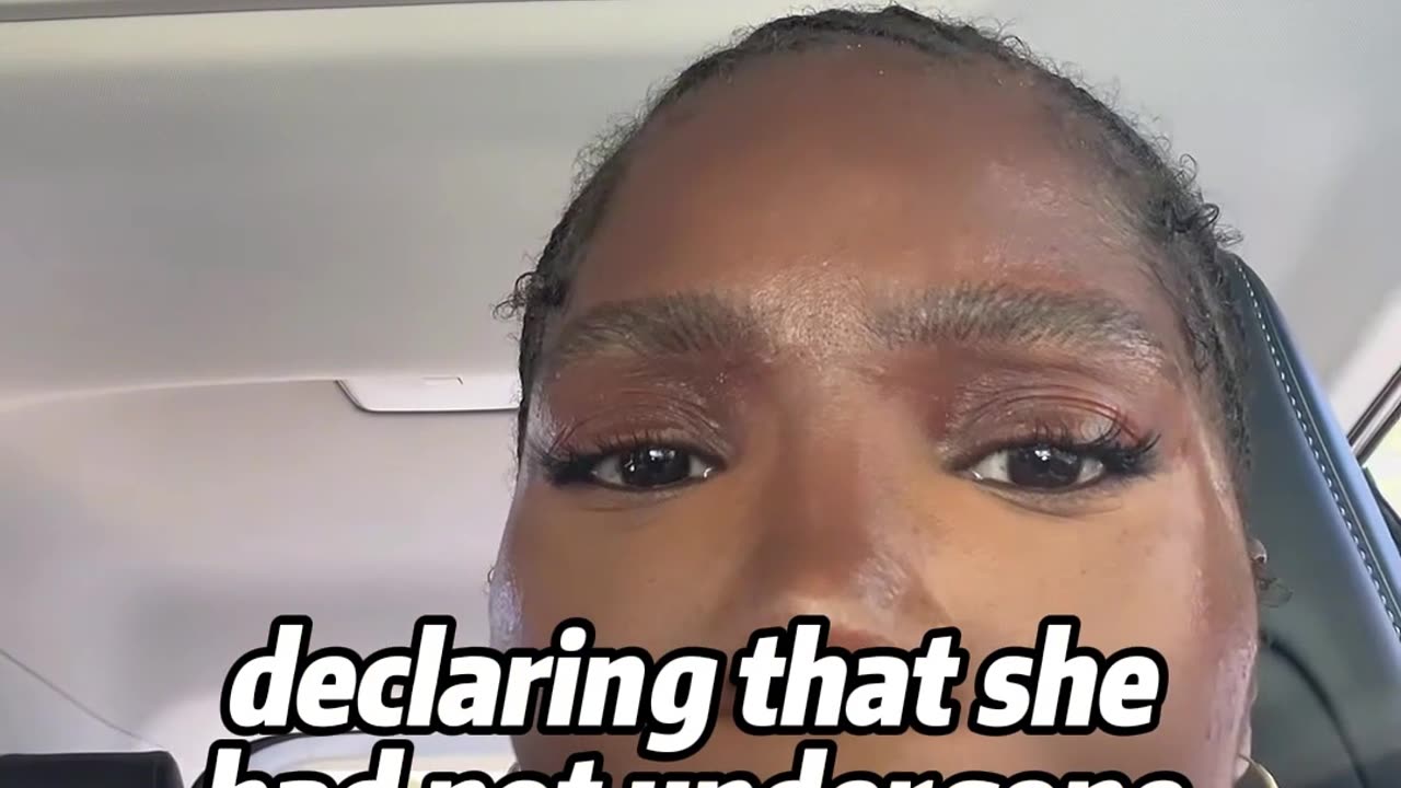 Why Dechi Wears Facial Tape Publicly — The Truth Will Inspire You