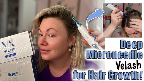 Deep Microneedle Velash for Hair Growth! AceCosm.com Code Jessica10 Saves you Money