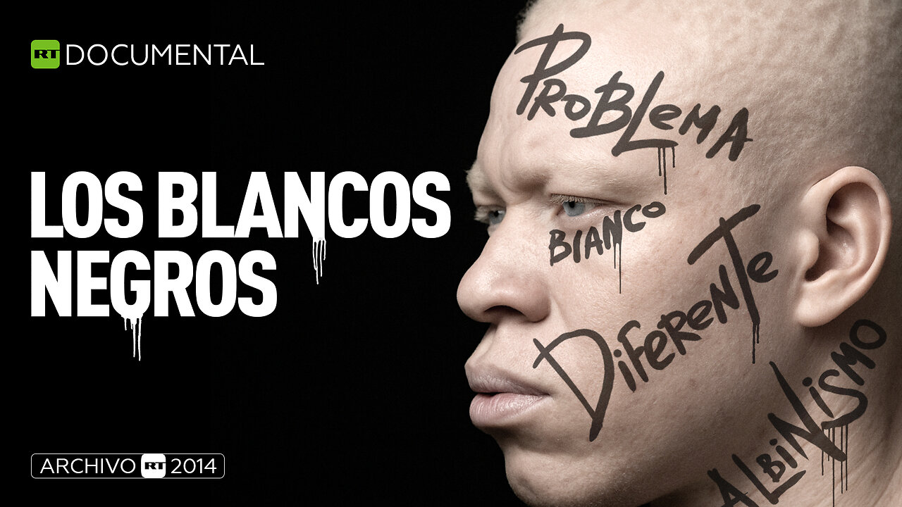 Los blancos negros - Documental RT (Archivo RT 2014)