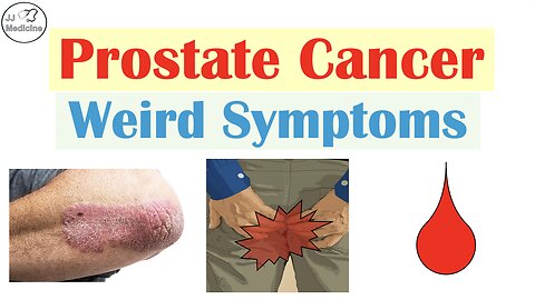 10 Weird Prostate Cancer Symptoms You’d Never Expect
