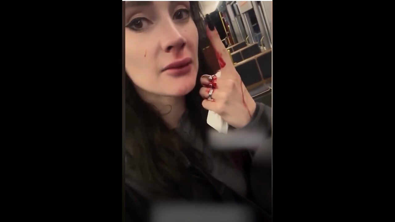 Frau in Zürich attackiert. Polizei: 🤷. England kocht! AfD triumphiert in NRW