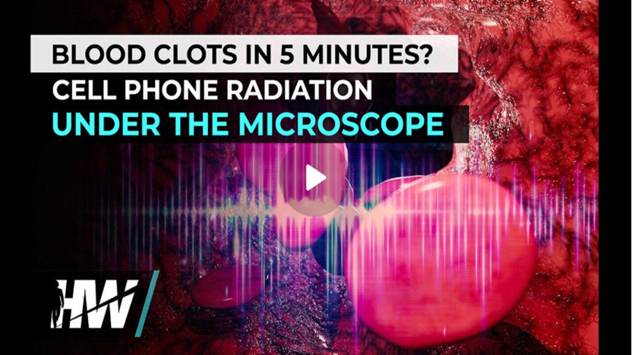 BLOOD CLOTS IN 5 MINUTES |CELL PHONE RADIATION UNDER THE MICROSCOPE