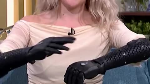 Tilly just became the first person in the WORLD to receive fully wireless bionic hands.