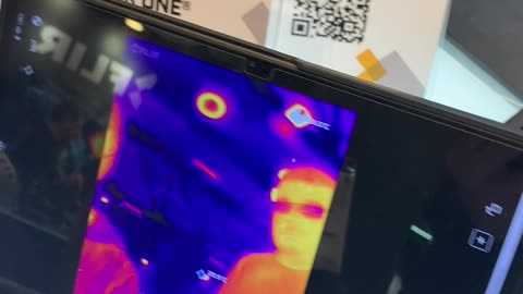 Medical thermal vision