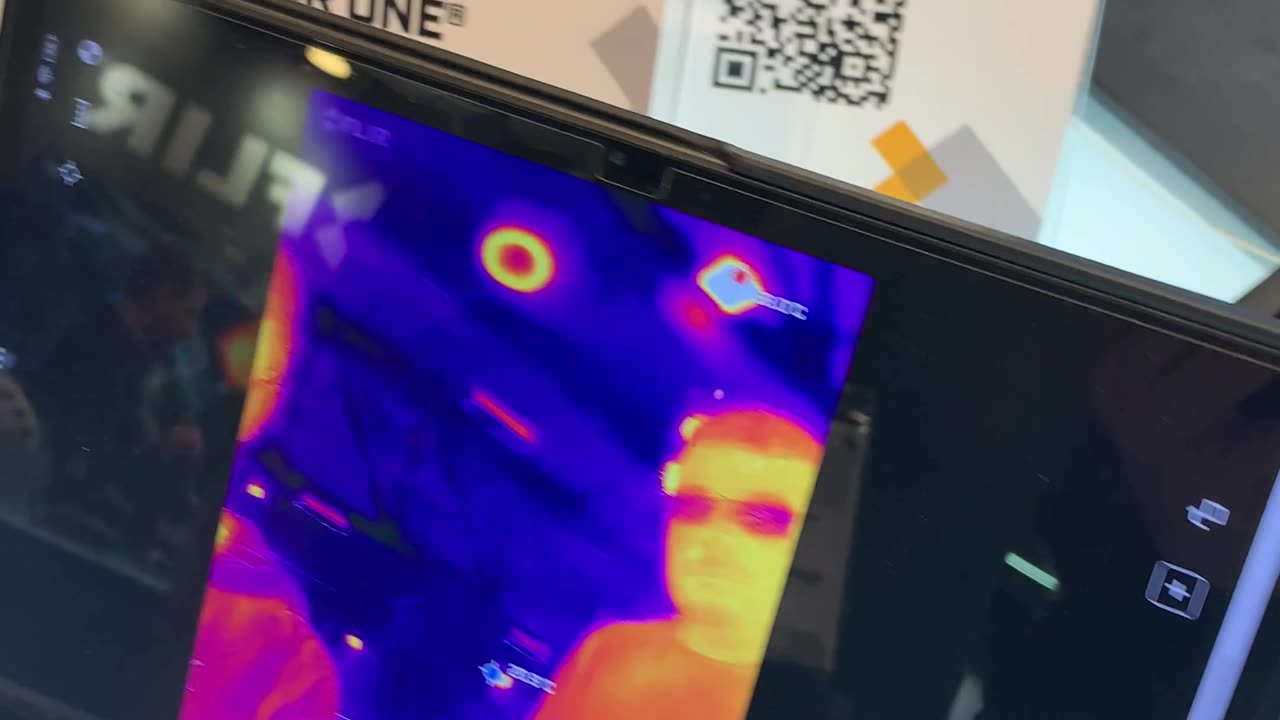 Medical thermal vision