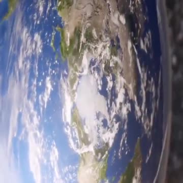 Globetardia Syndrome