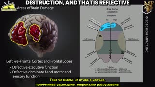 Ваксинираните с иРНК са с увредени мозъци