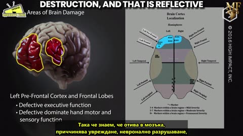 Ваксинираните с иРНК са с увредени мозъци