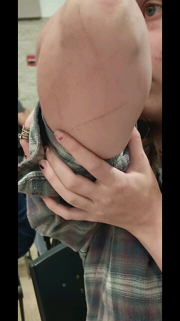 proof of Bev attacking me with sharp objects etc