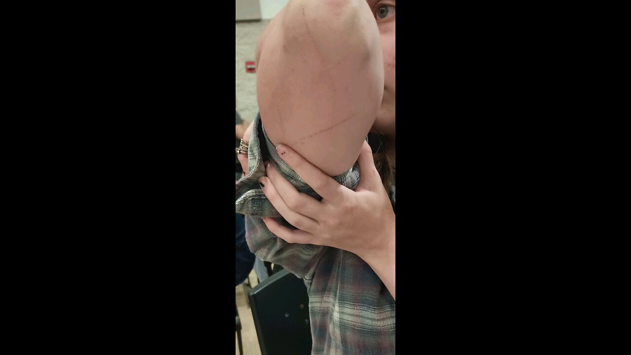 proof of Bev attacking me with sharp objects etc