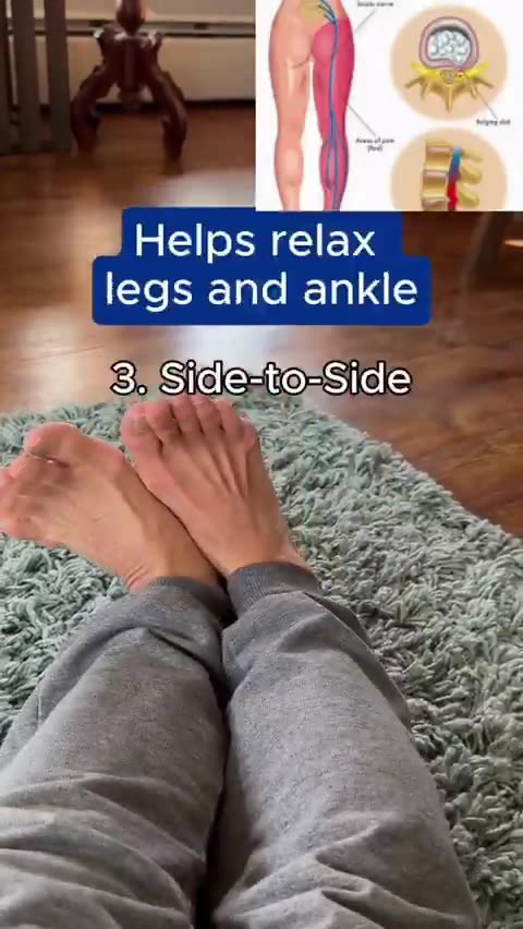 Sciatica + Varicose Vein relief 👇
