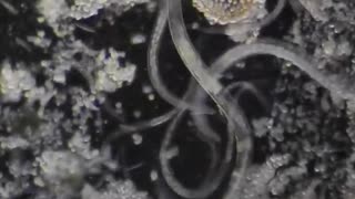 Nail dirt under a microscope