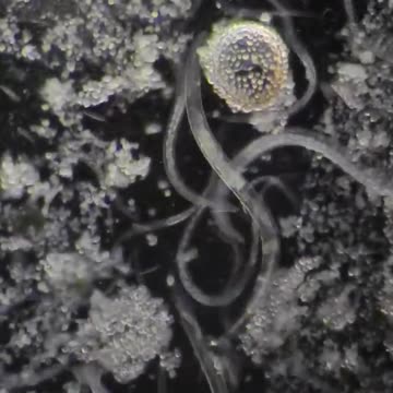Nail dirt under a microscope