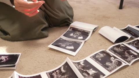 Advanced IVF & Fertility Treatments at Sumathi Hospital, Madurai