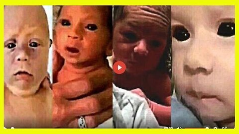 "Understanding Unique Traits: Pandemic Babies & Black-Eyed Babies (Parts 1 & 2)"