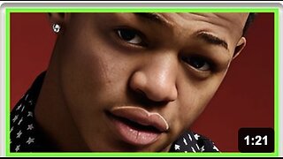 RAPPER’S FACE SWELLS LIKE A BALLOON AFTER MYSTERY ‘ALLERGY’