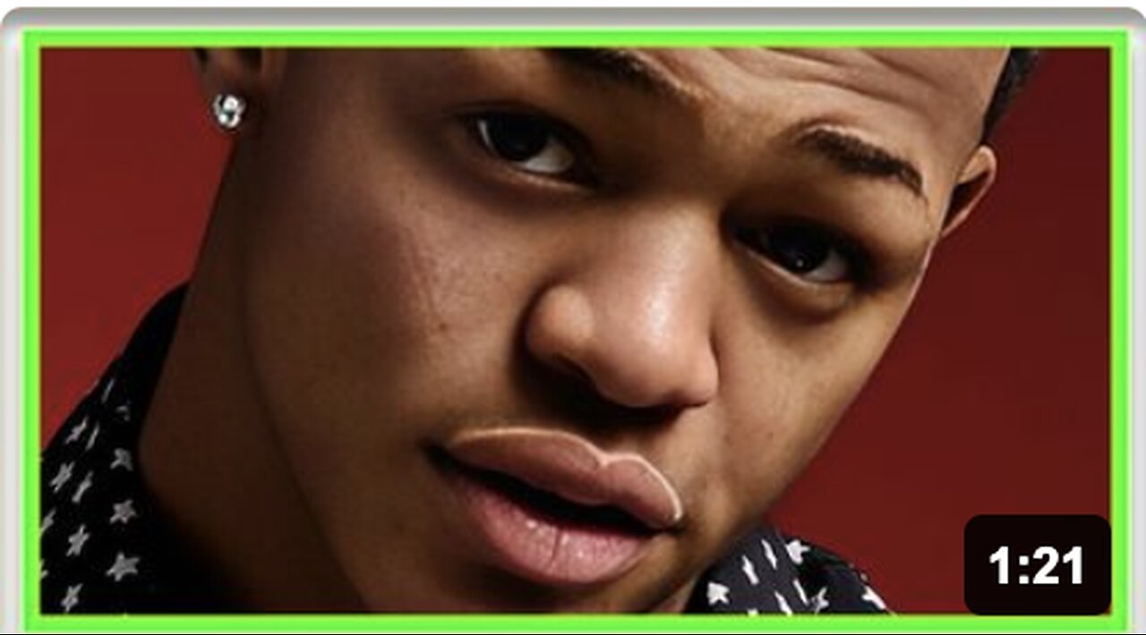 RAPPER’S FACE SWELLS LIKE A BALLOON AFTER MYSTERY ‘ALLERGY’