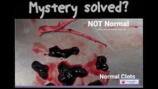 Mistery solved ¦ Rätsel gelöst? ➽Extra Cellular Biofilm Matrix (Hydrogel)