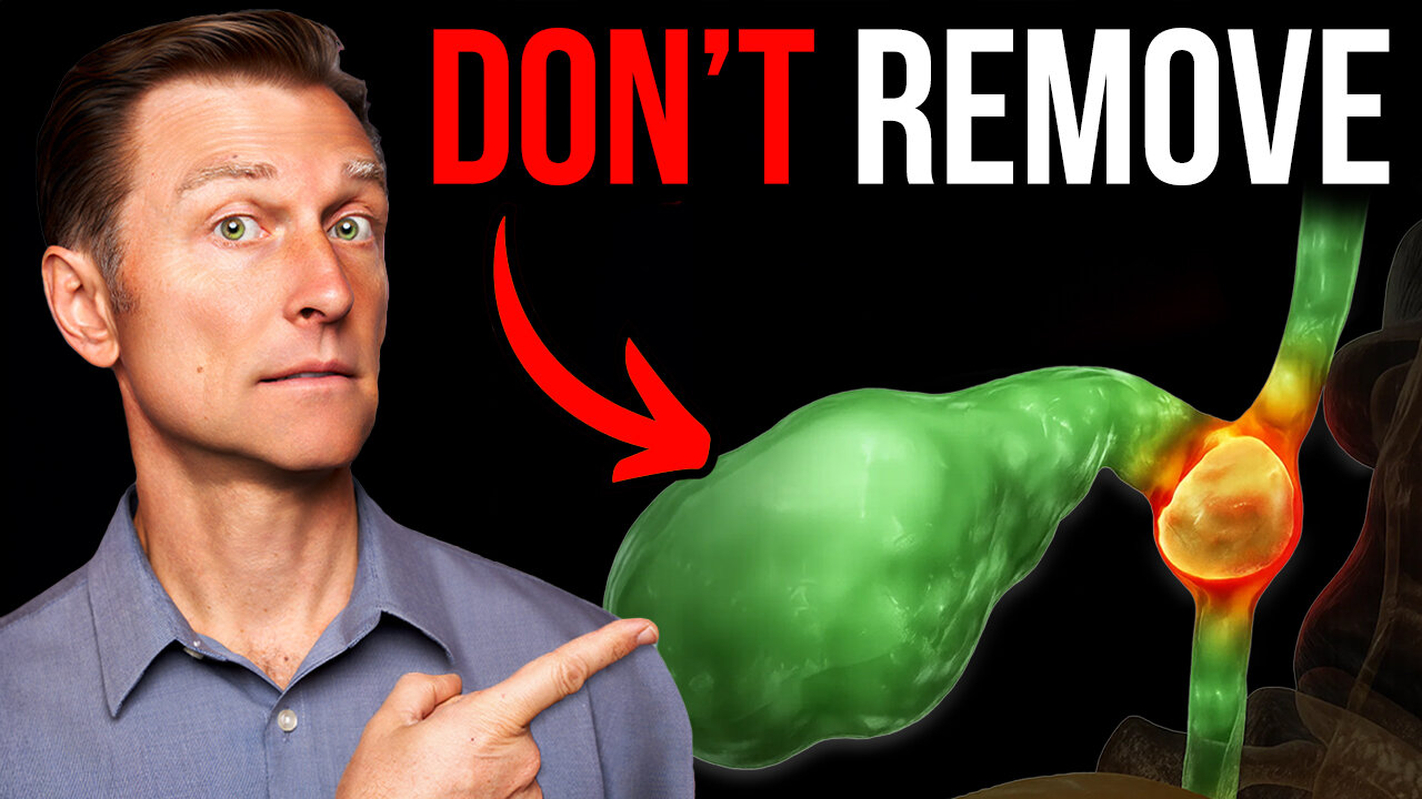 Never Get Your Gallbladder Removed