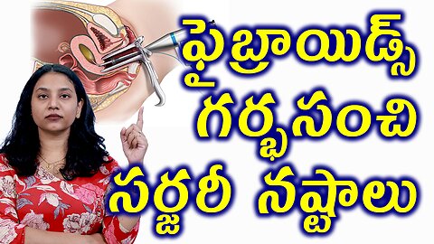 ఫైబ్రాయిడ్స్ గర్భసంచి సర్జరీ నష్టాలుBenifits & Risks of Hysterectomy,Uterus Removal Fibroids Surgery