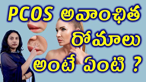 PCOS అవాంఛిత రోమాలు అంటే ఏంటి? What is Hirsutism Female Unwanted Hair Related to PCOS? Homeopathy