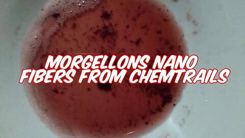 Unraveling the Mystery: Morgellons Spit Test Reveals Nano Fibers from Chemtrails