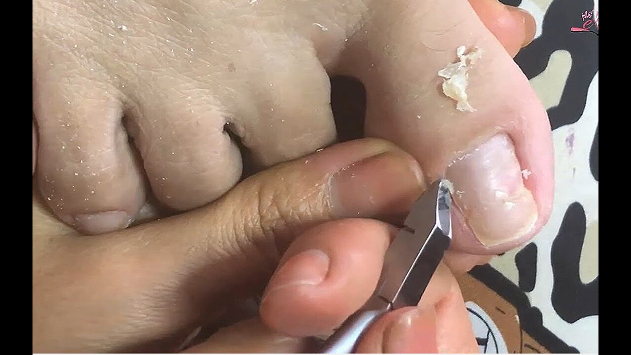 Cleaning is very needed! Home Service Pedicure Series #ingrowntoenail #toenails #pedicure (5)
