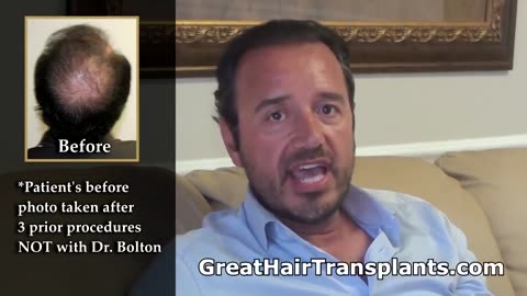 Dr. Brett Bolton – Can You Fix My Bad Transplants from Other Doctors?
