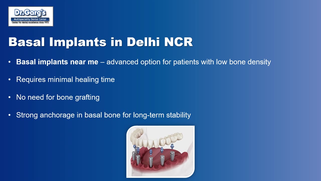 Affordable Dental Implants in Delhi NCR – Basal, Titanium & Zirconia at Dr. Garg’s Center