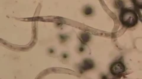 Baking Soda VS Human Parasites