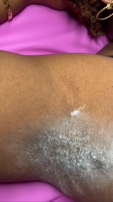 Underarm Waxing in California Using Sexy Smooth Lemon Kiss Wax by @waxing_with_mie 🍋💛
