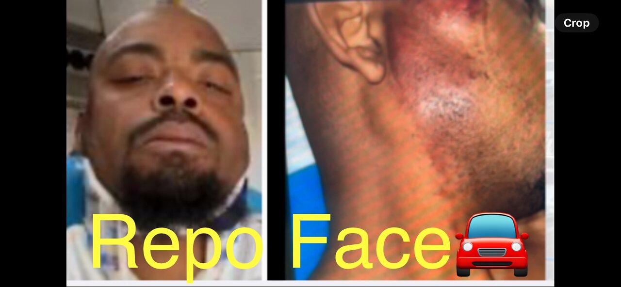 Driver runs over repo man’s head🚘