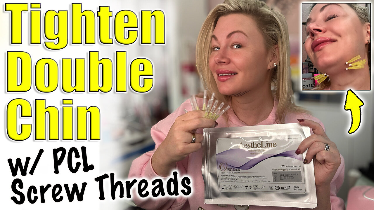 TIghten DOuble Chin with PCL Screw Threads! ACeCosm.com and code Jessica10 Saves you Money