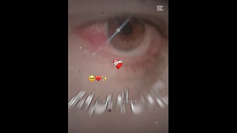 Sad song