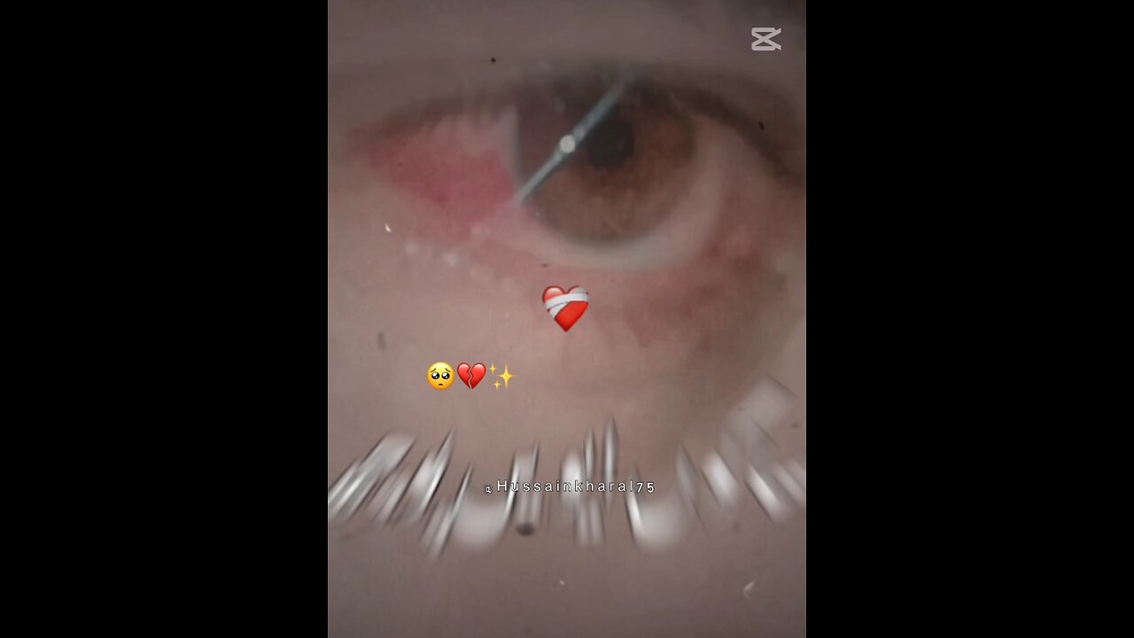 Sad song
