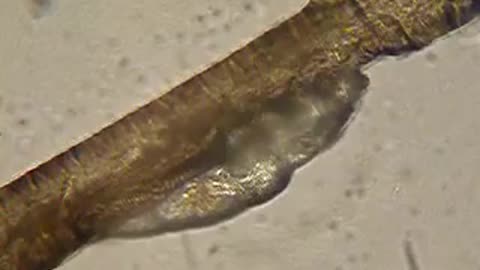 Eyelash mite moving along an eyelash We all have many of these hanging out at the base of each eyelash
