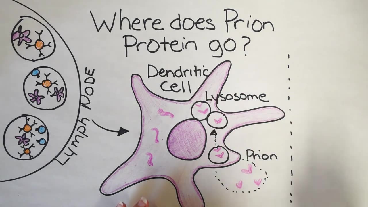 Prion Disease | How does Prion Disease Happen