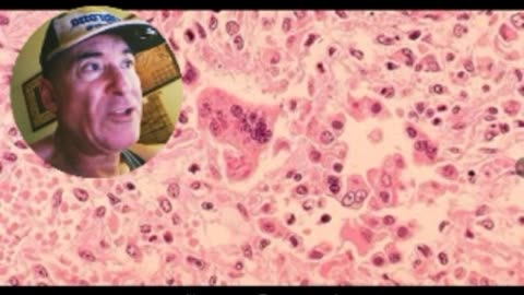 NORTH DAKOTA COMMUNITY QUARANTINES UNVAXXED STUDENTS, U.S. SUMMER GRID DOWN WARNING