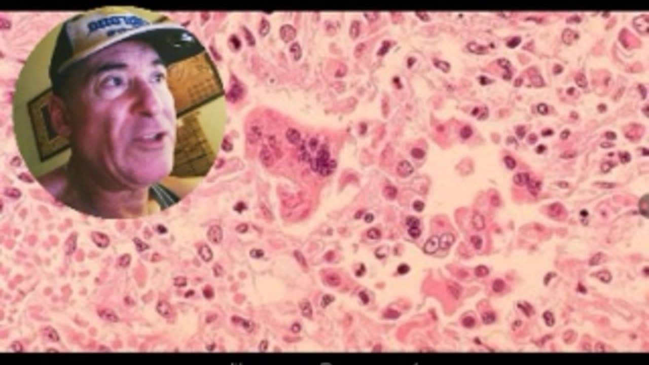 NORTH DAKOTA COMMUNITY QUARANTINES UNVAXXED STUDENTS, U.S. SUMMER GRID DOWN WARNING