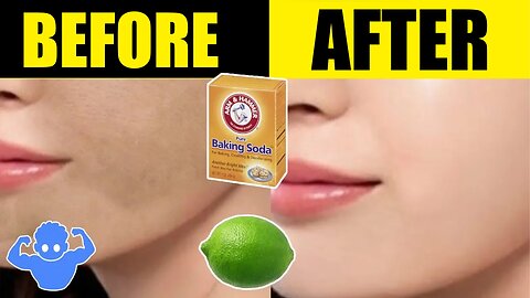 WHITEN your Crotch, Neck, Armpits and Elbows with THIS Home Remedies