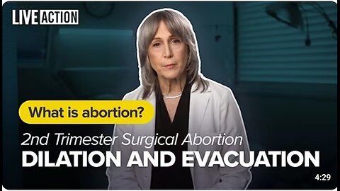 Abortion is Barbaric! 2nd Trimester Abortion | Dilation and Evacuation (D&E) | What Is Abortion?