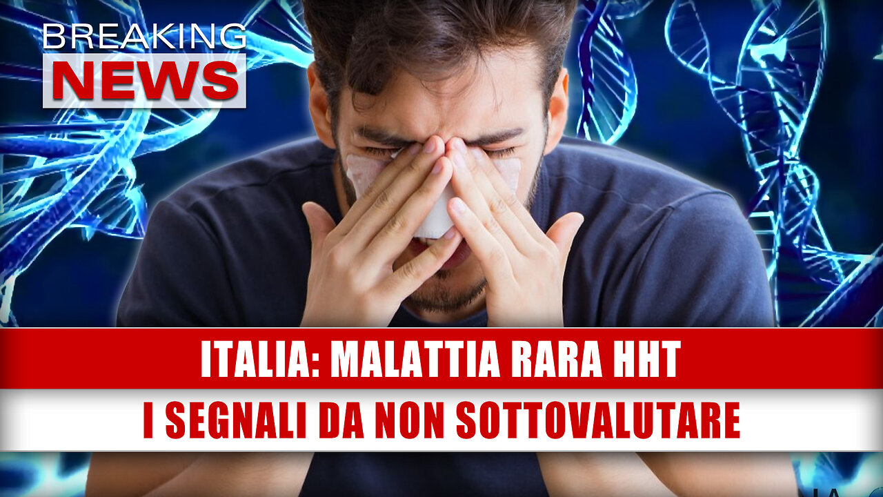 Italia, Malattia Rara HHT: I Segnali Da Non Sottovalutare!