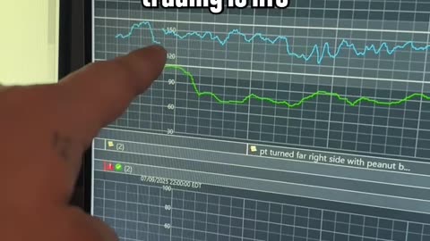 Only A Trader Can Find This Funny😭😭😭😭