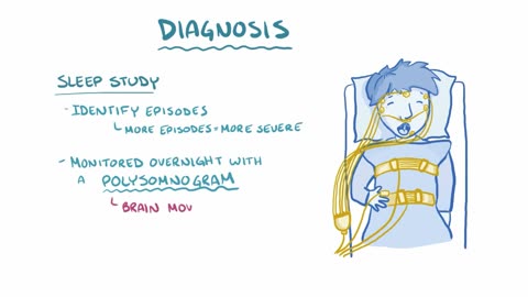 Sleep apnea - causes, symptoms, diagnosis, treatment, pathology