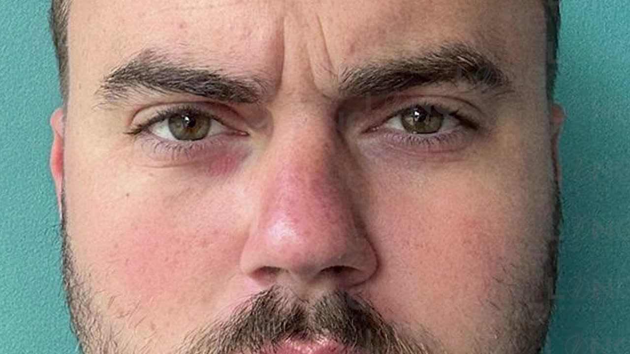 Being bald doesn't have to be a nightmare. Long Hair Centre is here to help.