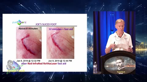TT2503 Joe Blanton - Self-Healing ReVitaLazers!