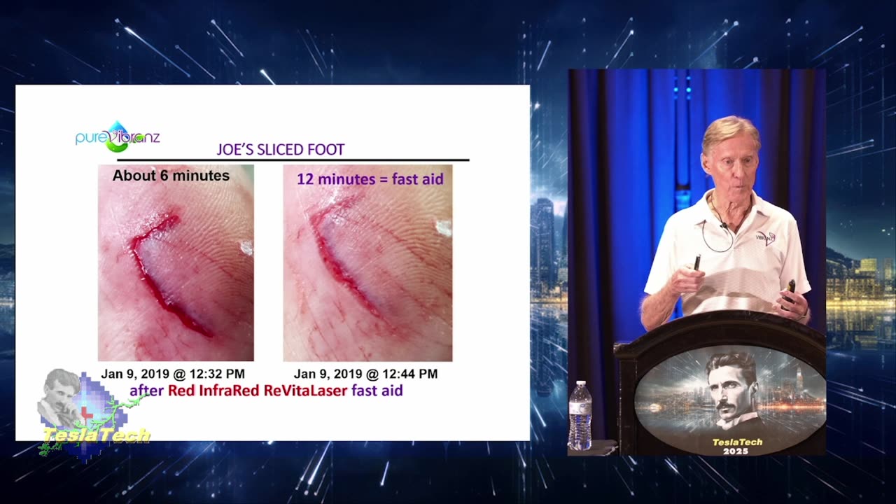 TT2503 Joe Blanton - Self-Healing ReVitaLazers!