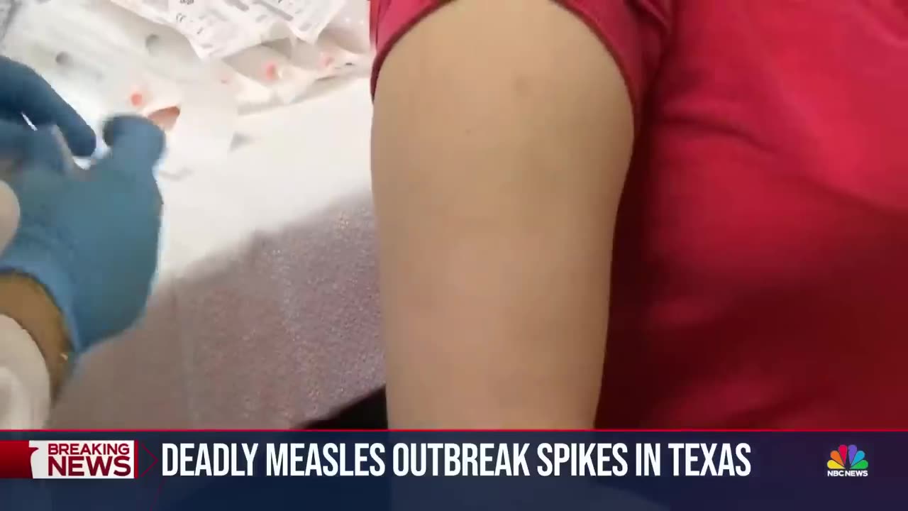 Texas measles outbreak explodes to nearly 500 cases