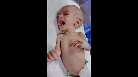 baby abubakar is crying for feed